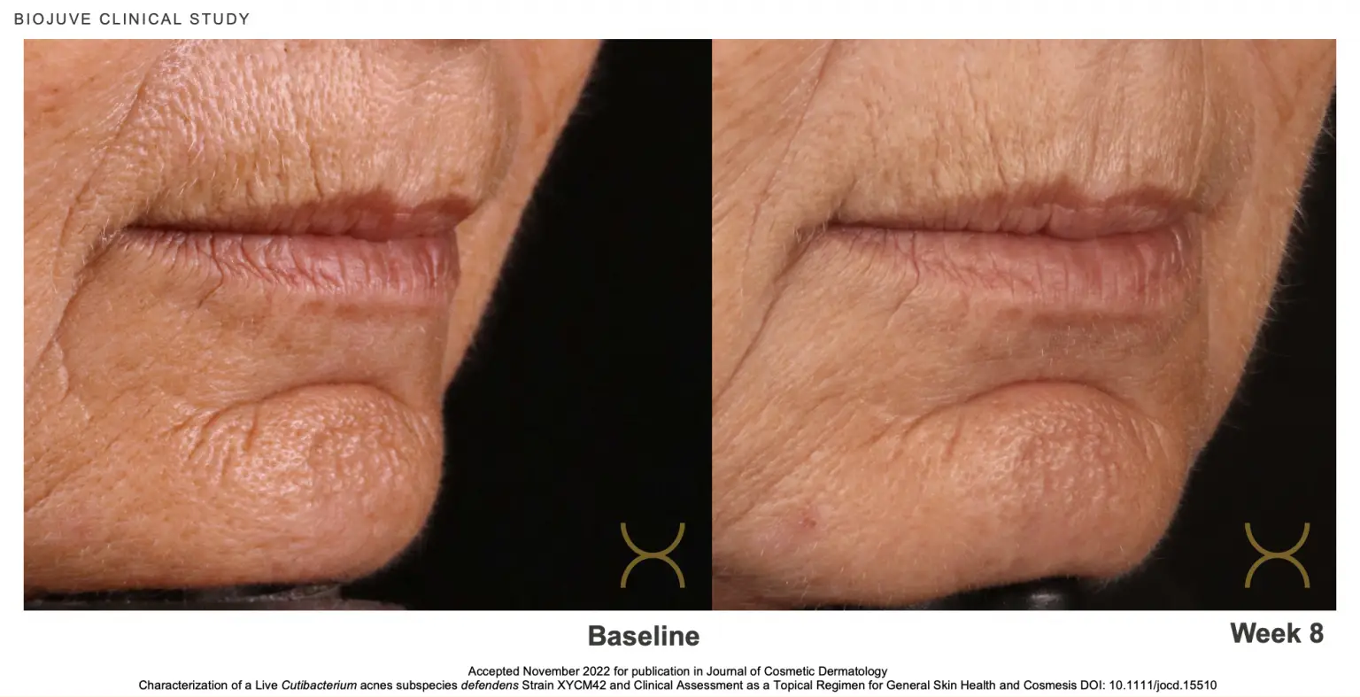 biojuve before and after skincare wrinkles