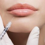 Lip Filler Dermal Filler Lip plump Lip shape