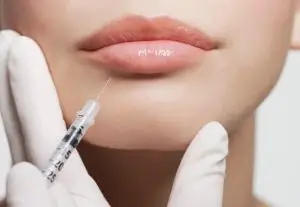 Lip Filler Dermal Filler Lip plump Lip shape