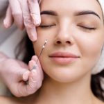 PDO Threads thread lift smooth threads nonsurgical face lift collagen