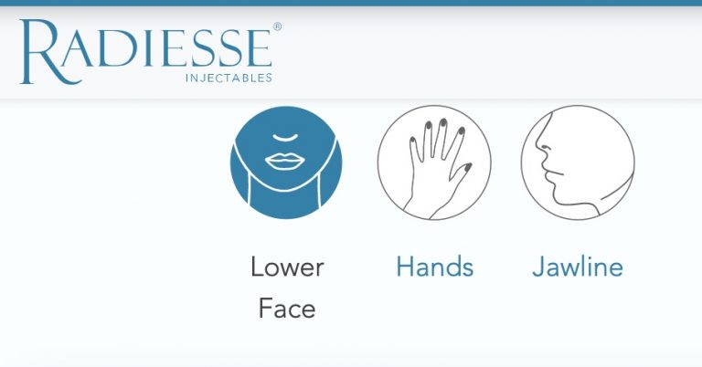 Radiesse Filler