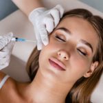 Sculptra Collagen Volume Cheeks